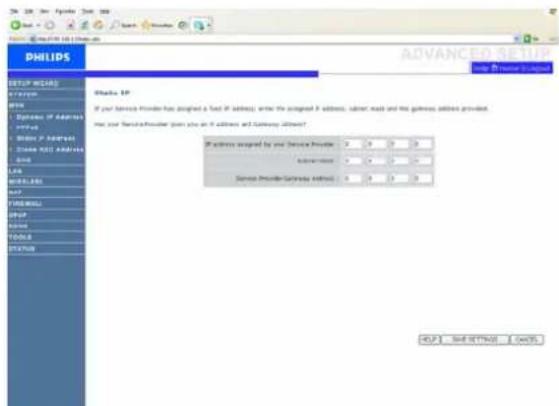 PHILIPS SNB5600 - Adresse IP statique/Static IP Address - 1