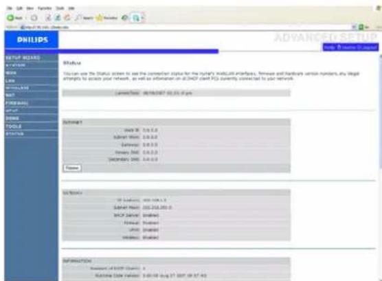 PHILIPS SNB5600 - ETAT/STATUS - 1