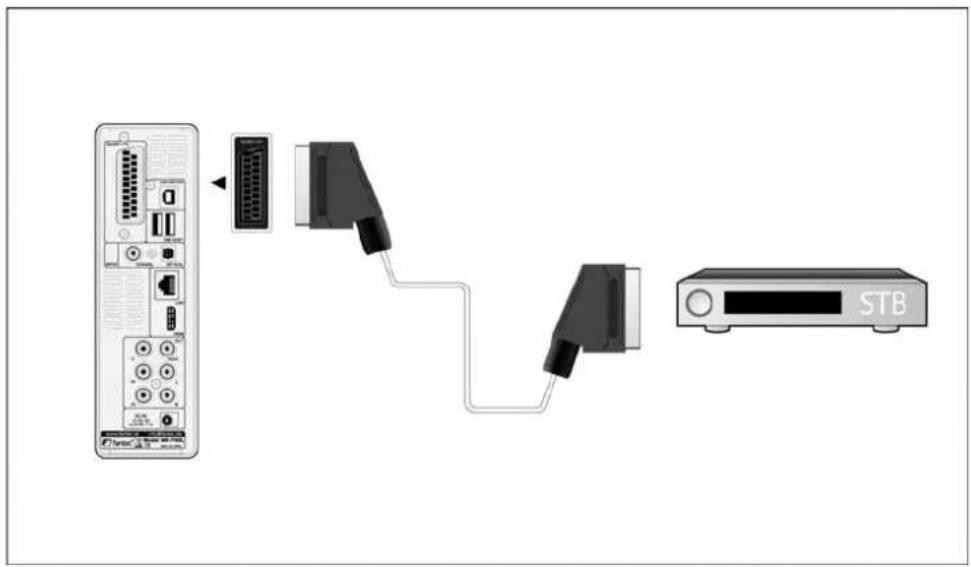 Fantec MMFHDL - SORTIE PERITEL - 1