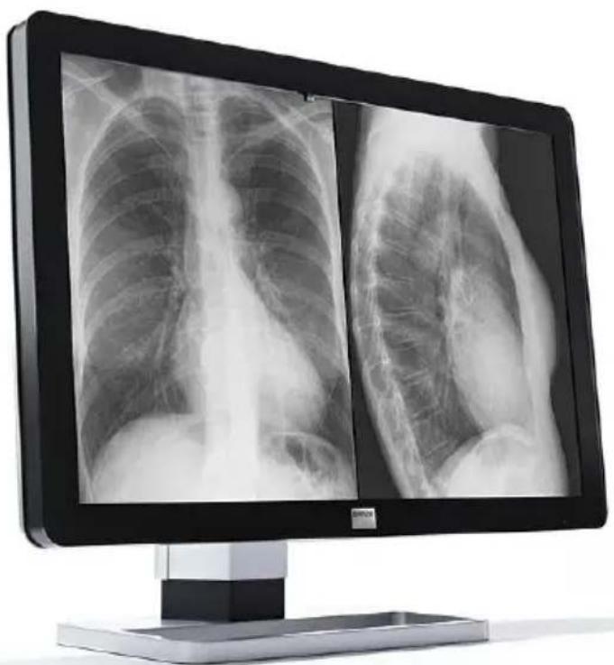 Barco Coronis Fusion 10MP - 1