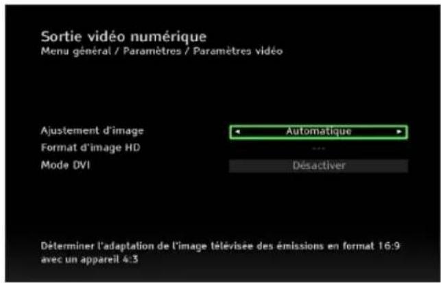 PHILIPS DSR5020 - Sortie video numérique - 1