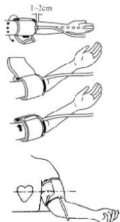 KONIG HCBLDPRESS21 - APPLYING THE CUFF - 1