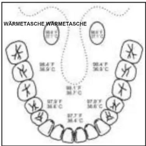 WÄRMETASCHE WÄRMETASCHE 98.4 F 36.9 C 98.4 F 36.9 C 98.1 F 36.7 C 97.9 F 36.6 C 97.9 F 36.6 C 97.7 F 36.4 C