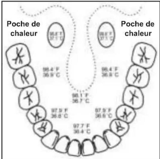 Poche de chaleur 98.4 F 37.5 °C 98.4 F 37.5 °C 98.4 F 36.8 °C 98.1 F 36.7 °C 97.9 F 36.8 °C 97.9 F 36.8 °C 97.7 F 36.4 °C Poche de chaleur