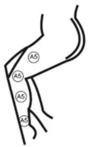 KONIG HCSM10 - Maintenance and storage of electrode pads: - 5