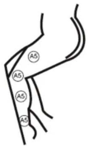 KONIG HCSM10 - Entretien et stockage des pastilles d'electrodes : - 5