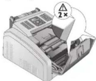 PHILIPS Laserfax LPF5135 - Bords sur le couvercle de l'appareil! - 1