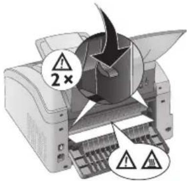 PHILIPS Laserfax LPF5135 - Pieces de l'equipement chaudes! - 1