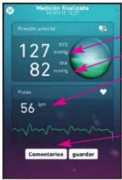 MEDISANA CardioDock 2 - El resultado de la medición - 1