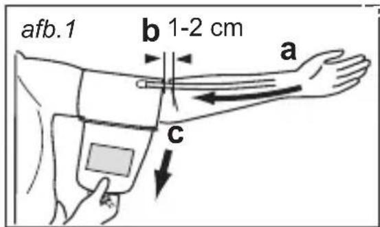 MEDISANA CardioDock 2 - Aanbrengen van de bovenarmmanchet - 1