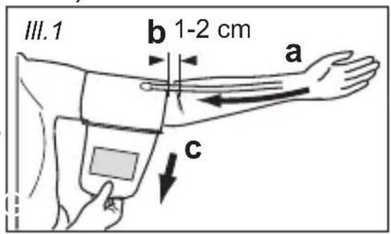 MEDISANA CardioDock 2 - Pose du brassard sur le bras - 1