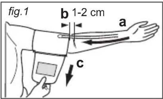MEDISANA CardioDock 2 - Colocación del brazalete - 1