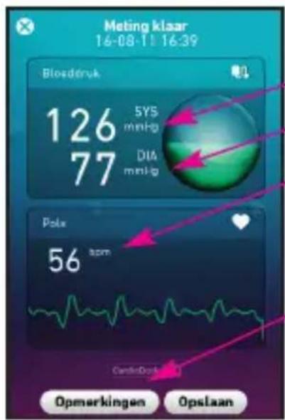 MEDISANA CardioDock 2 - Het meetresultaat - 1