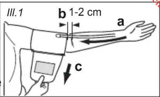 MEDISANA CardioDock 2 - Putting on the upper arm pressure cuff - 1