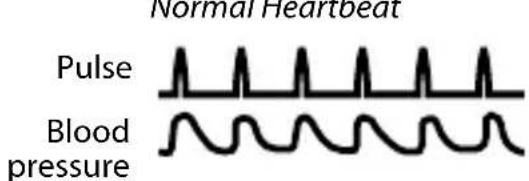 OMRON BP629 - MOVEMENT ERROR SYMBOL - 2