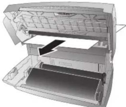 PHILIPS Magic 5 Eco PPF620E - Eliminer le bourrage de papier - 3