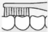 PANASONIC EWDS90QP - Occlusion (dents arrriere) - 1
