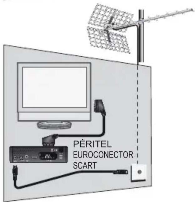 METRONIC Zapbox HDM1.1 - A - Instalación simplificada - 2