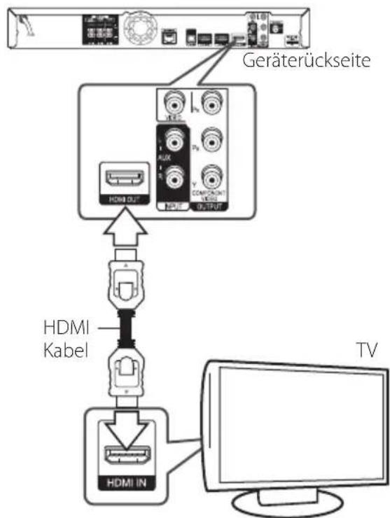PIONEER BCSSB616 - HDMI-Anschluss - 1