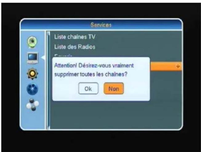 SetOne EasyOne SHD 4U - Supprimer - 2