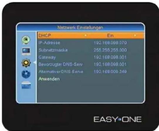 SetOne EasyOne SHD 4U - Netzwerk Einstellungen - 2