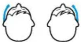 SENNHEISER HSP 4 - Attaching the microphone to the left or right side - 1