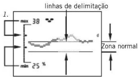 SOEHNLE Body Balance Slim FT4 - Indicação de tendência - 1