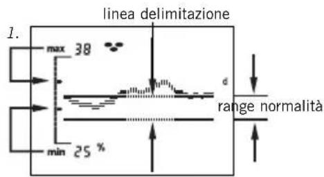SOEHNLE Body Balance Slim FT4 - Visualizzazione dell'andamento - 1