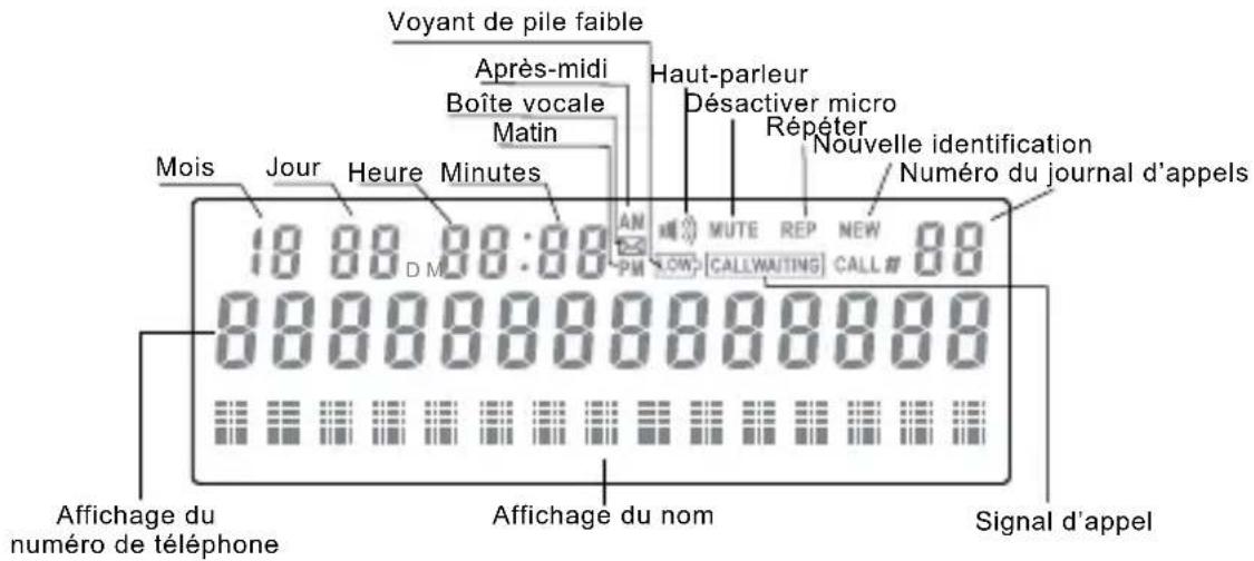 SWISSVOICE CP40 - Affichages et touches - 1