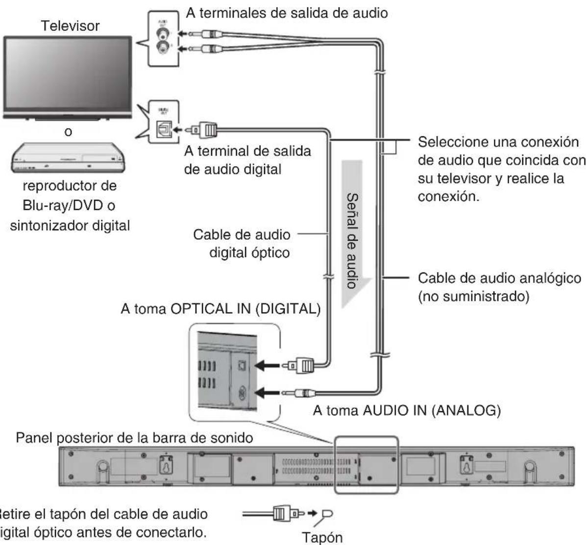ONKYO SBT200 - Conexión de un televisor, reproductor de DVD, etc. - 1