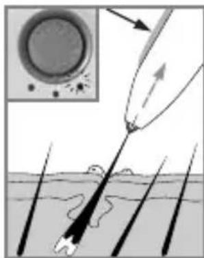 RIO CNHR - EINLEGENDER BATTERIE - 6