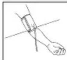 TOPCOM BD4600 - Applying the cuff - 5