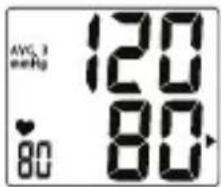 TOPCOM BD4601 - Recuperación de datos - 2