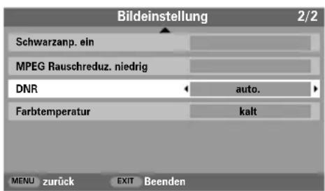 TOSHIBA 42C3035DG - Digitale Rauschunterrückung (DNR) - 1