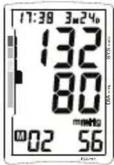 TOPCOM BPM ARM 5500 XLD - Verfahren - 2