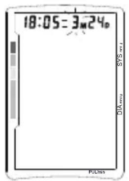 TOPCOM BPM ARM 5500 XLD - NastavenieČasu - 1