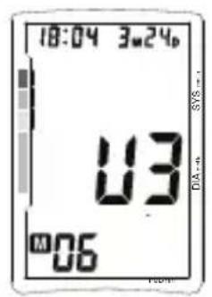 TOPCOM BPM ARM 5500 XLD - Speicher - 1