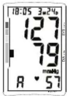 TOPCOM BPM ARM 5500 XLD - Memorie - 2