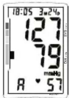 TOPCOM BPM ARM 5500 XLD - Memorial - 2