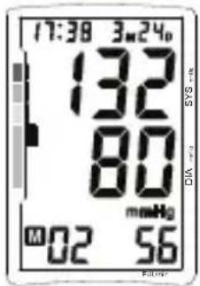 TOPCOM BPM ARM 5500 XLD - Procédure - 2