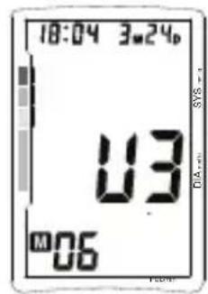 TOPCOM BPM ARM 5500 XLD - Pamě - 1