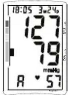TOPCOM BPM ARM 5500 XLD - Mvñμn - 2