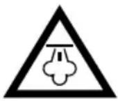 SEVERIN Hygenius Delight ST 7181 - Vapore caldo e parti dell'apparecchio calde - 1