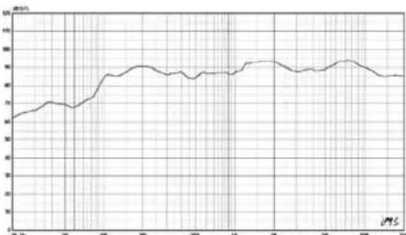 VISION SP1300B - ACCESSIONS INCLUs - 2