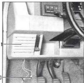 RENAULT 5 (1989) - Anomalies de fonctionnement - 5