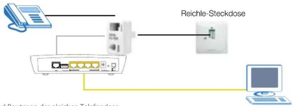 ZYXEL P661HNUI - Analoger Telefonanschluss Variante 1 - 1