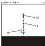 Cabstone TV EasyScope L - Information for VESA-Standard: - 7