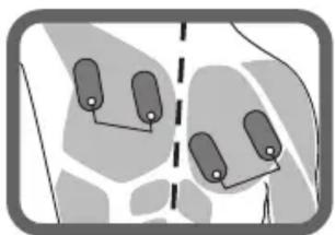 LANAFORM Body Stim - 1) Préparation avant utilisation - 1