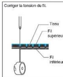 BROTHER PQ1500 - Tension des fils - 1