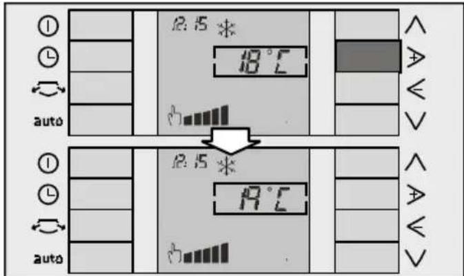 SIEMENS PA 20001 M - Tasti + e - - 1